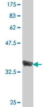 SPRY1 polyclonal antibody (A01)