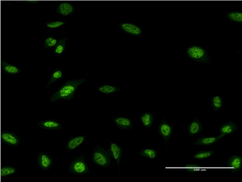 OLIG2 monoclonal antibody (M03), clone 3C9