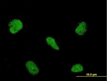 RBM5 monoclonal antibody (M01), clone 2B6