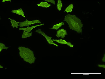 DHRS9 monoclonal antibody (M05), clone 3C6