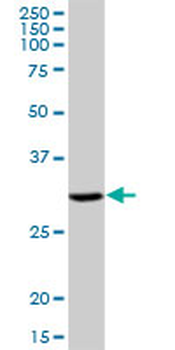 DHRS9 purified MaxPab mouse polyclonal antibody (B01P)