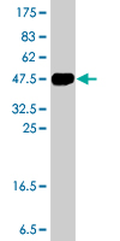 ZNF263 polyclonal antibody (A01)