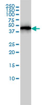 ACTR3 monoclonal antibody (M02), clone 2B6