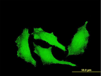 ATP9A monoclonal antibody (M02), clone 3G2