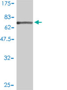 SAE1 monoclonal antibody (M01), clone 1G4-1G5