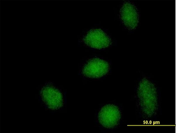 DNAJB6 MaxPab mouse polyclonal antibody (B01)