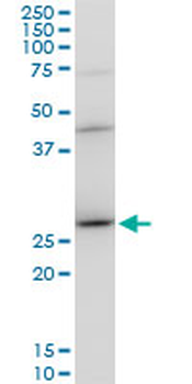 DNAJB6 polyclonal antibody (A01)