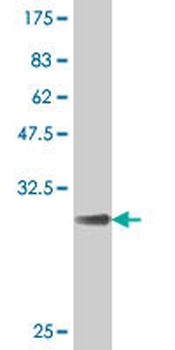 KCNE2 polyclonal antibody (A01)