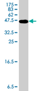 SLC12A6 polyclonal antibody (A01)