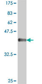 MED12 polyclonal antibody (A01)