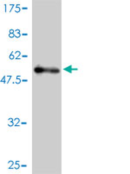 USP15 monoclonal antibody (M01), clone 1C10