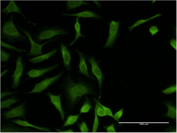 OXSR1 monoclonal antibody (M06), clone 1C8