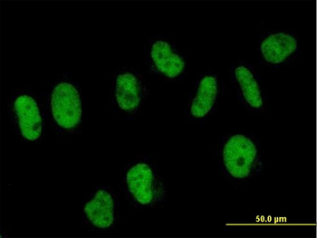 SART3 MaxPab mouse polyclonal antibody (B01)