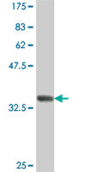 HERPUD1 polyclonal antibody (A01)