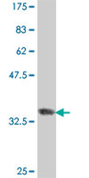 UBE3C polyclonal antibody (A01)