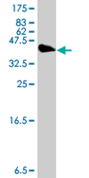 EIF5B polyclonal antibody (A01)