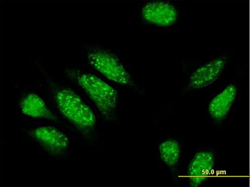 PDE4DIP MaxPab mouse polyclonal antibody (B01)