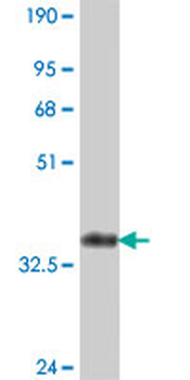 CDC42BPB polyclonal antibody (A01)