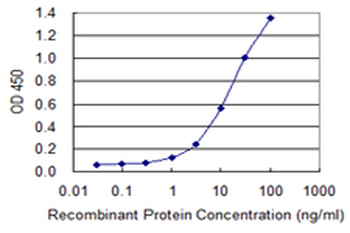 ROCK2 monoclonal antibody (M02), clone 1E12