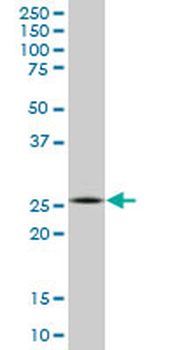 ATG5 monoclonal antibody (M04), clone 1G11