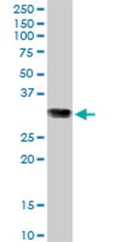 GSTO1 purified MaxPab mouse polyclonal antibody (B01P)