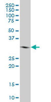 GSTO1 polyclonal antibody (A01)