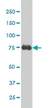 CRSP6 monoclonal antibody (M02), clone 1B5