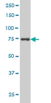CRSP6 monoclonal antibody (M01), clone 4D4
