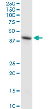 HS6ST1 monoclonal antibody (M05A), clone 1H4