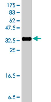 NRXN1 polyclonal antibody (A01)