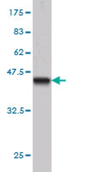 BCL7B monoclonal antibody (M01), clone 6D2
