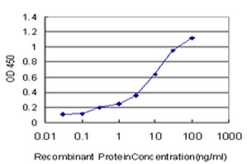 MAGI1 monoclonal antibody (M03), clone 7B4