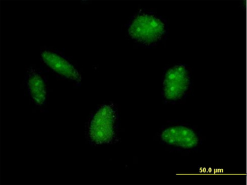 EXO1 purified MaxPab mouse polyclonal antibody (B01P)