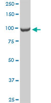 CTDP1 monoclonal antibody (M04), clone 3G4
