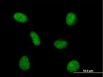 PRPF4 purified MaxPab mouse polyclonal antibody (B01P)