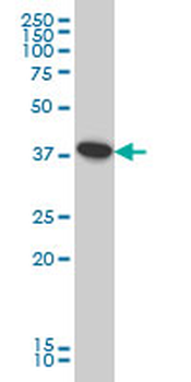 ATP6V0D1 monoclonal antibody (M01), clone 2G12
