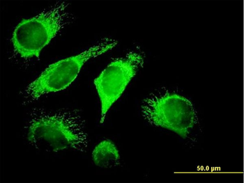 DNAJA3 MaxPab mouse polyclonal antibody (B01)