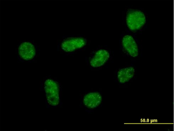 SART1 purified MaxPab mouse polyclonal antibody (B01P)