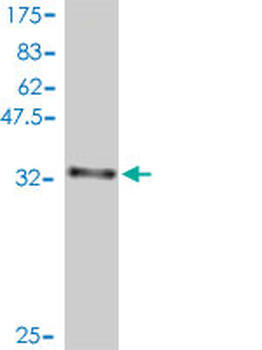 DIRAS3 polyclonal antibody (A01)