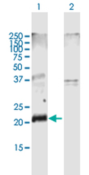 CLDN10 MaxPab mouse polyclonal antibody (B01)