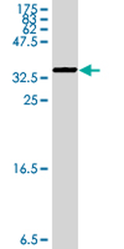 MAP3K6 polyclonal antibody (A01)