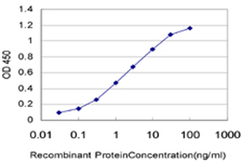 PAPSS2 monoclonal antibody (M07), clone 2A8