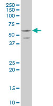 SLC13A2 polyclonal antibody (A01)