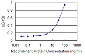 PSTPIP1 monoclonal antibody (M02), clone 1D5