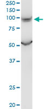 PKD2L1 monoclonal antibody (M01), clone 4F9