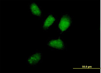 RNF8 purified MaxPab mouse polyclonal antibody (B01P)