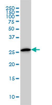 CLIC3 monoclonal antibody (M02), clone 3F8