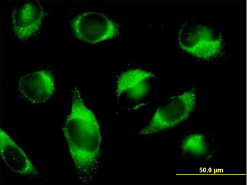 PLOD3 purified MaxPab mouse polyclonal antibody (B01P)