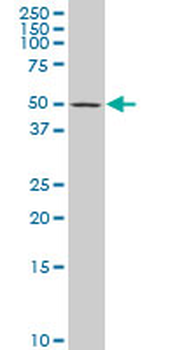 AP1M1 polyclonal antibody (A01)