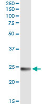 WISP2 MaxPab rabbit polyclonal antibody (D01)
